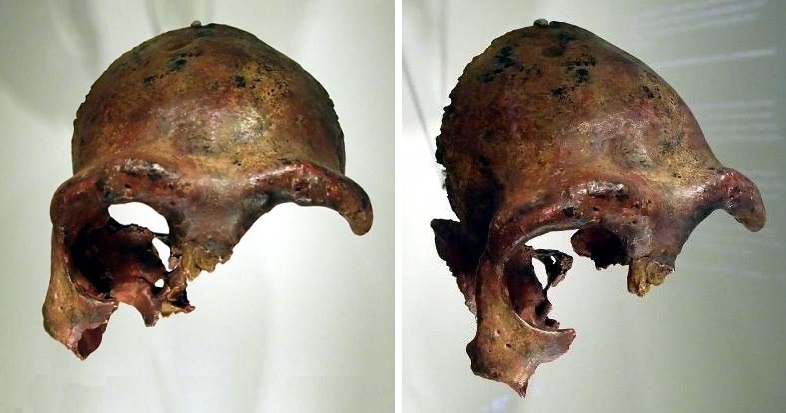 32 Galilee man - skull.JPG